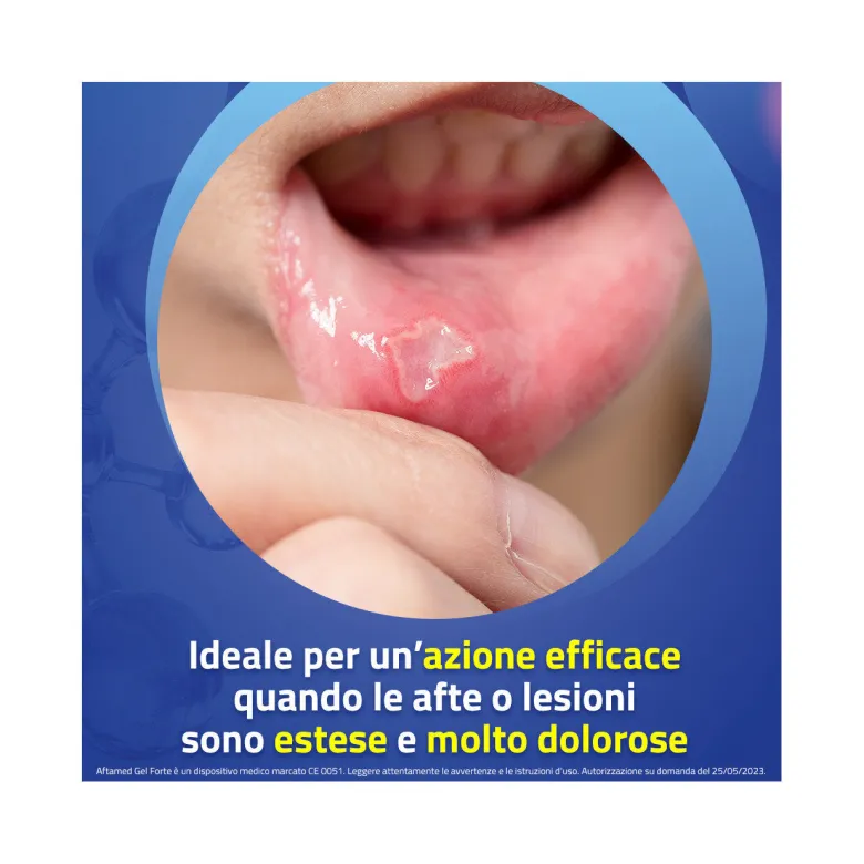 Aftamed Forte Gel Orale Alta Intensità 8ml Sollievo Rapido