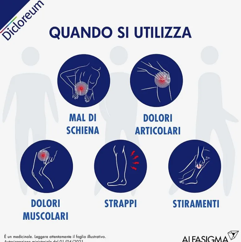 Dicloreum Antinfiammatorio Locale 3% Schiuma 50g