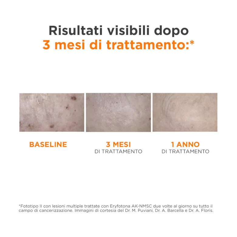 Isdin Eryfotona AK-NMSC Fluid SPF100+ 50ml - Protezione Solare