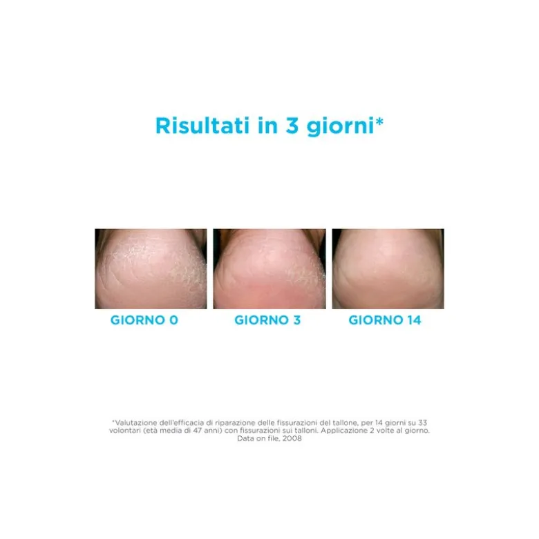 Isdin Ureadin Podos Gel Oil Idratante Per Piedi Secchi 75ml