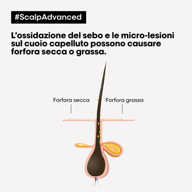LP SE Scalp A-Dndrf Shp 500 R VB98