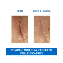 Uriage Bariéderm Cica-Crema Cu-Zn riparatrice 40ml