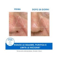 Uriage D.S. Emulsione 40ml