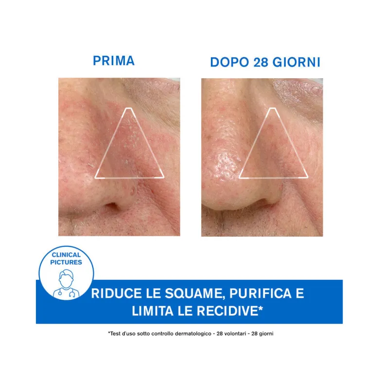 Uriage D.S. Emulsione 40ml