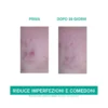 Uriage Hyseac 3 Regul+ Trattamento Globale Anti-imperfezioni 40ml
