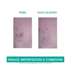 Uriage Hyseac 3 Regul+ Trattamento Globale Anti-imperfezioni 40ml