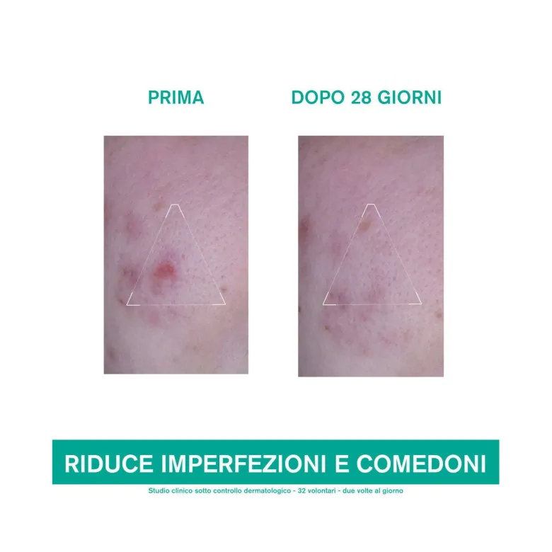 Uriage Hyseac 3 Regul+ Trattamento Globale Anti-imperfezioni 40ml