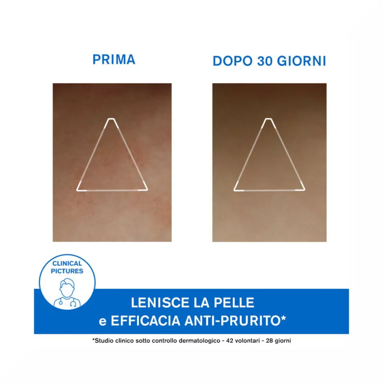 Uriage Xémose Cerato liporestitutivo anti-irritazioni 200ml
